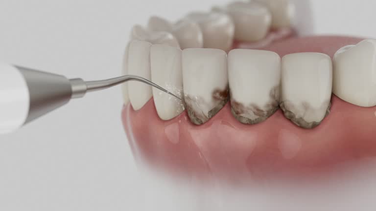 Reliable Dental Implants contractor in Mansfield, MO by Smile Center Dentistry